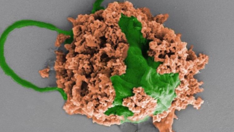 Pneumonia-Killing Microbots Cure Disease in New Study