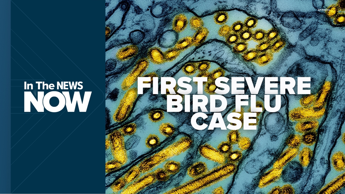 First Severe Human Case Of Bird Flu In U.S. | In The News Now | Wgrz.com