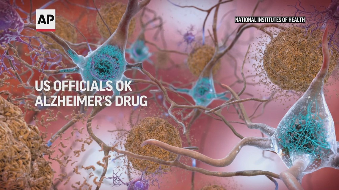 US officials OK new Alzheimer's drug