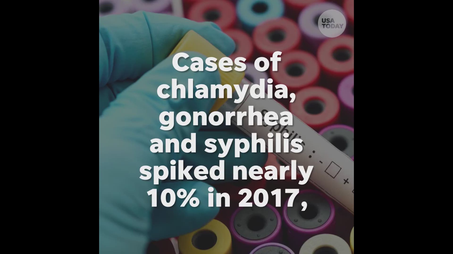Sexually Transmitted Diseases Surge For The 4th Straight Year Cdc 1737