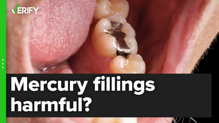 Mercury that is found in dental fillings is safe for most adults and kids
