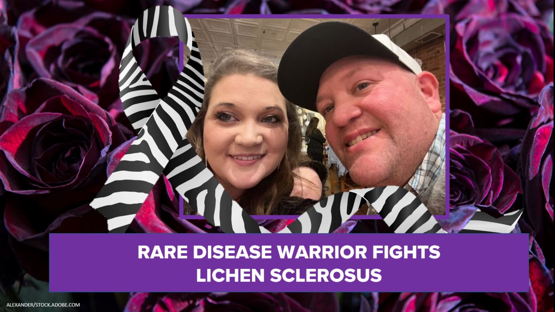 Carrie Hodgin has battled Lichen Sclerosus for nearly two decades. She said she’s finally getting her voice back and wants to help save lives.