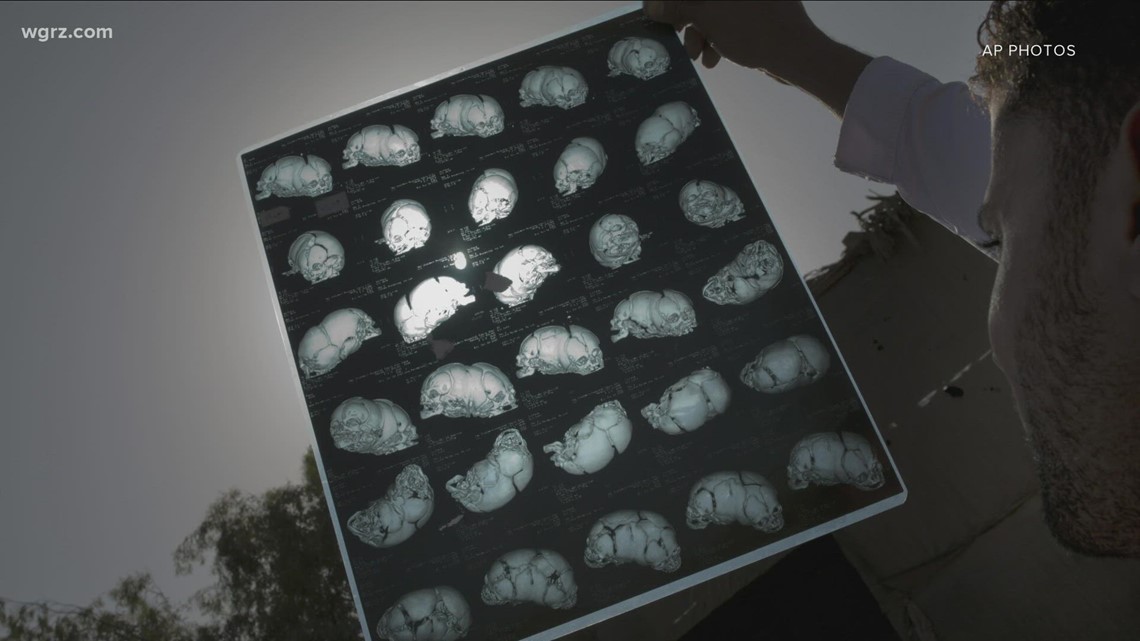 Hospitals in WNY, nationwide deal with CT scan dye shortage due to COVID lockdowns in China
