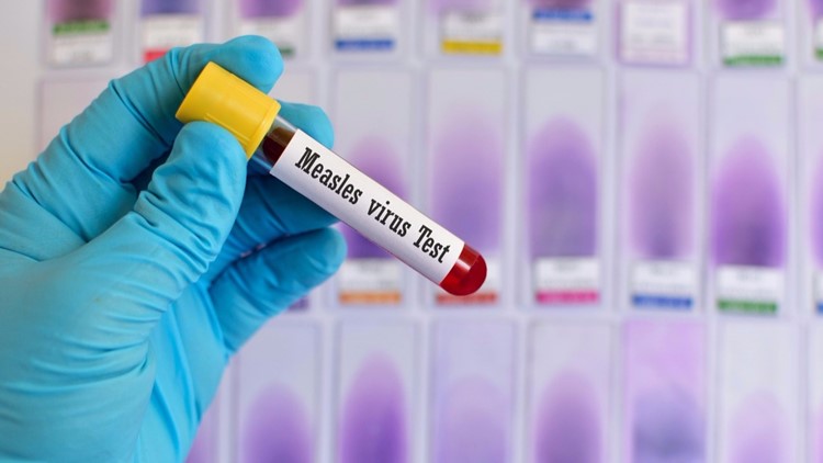 Potential Measles Exposure In WNY
