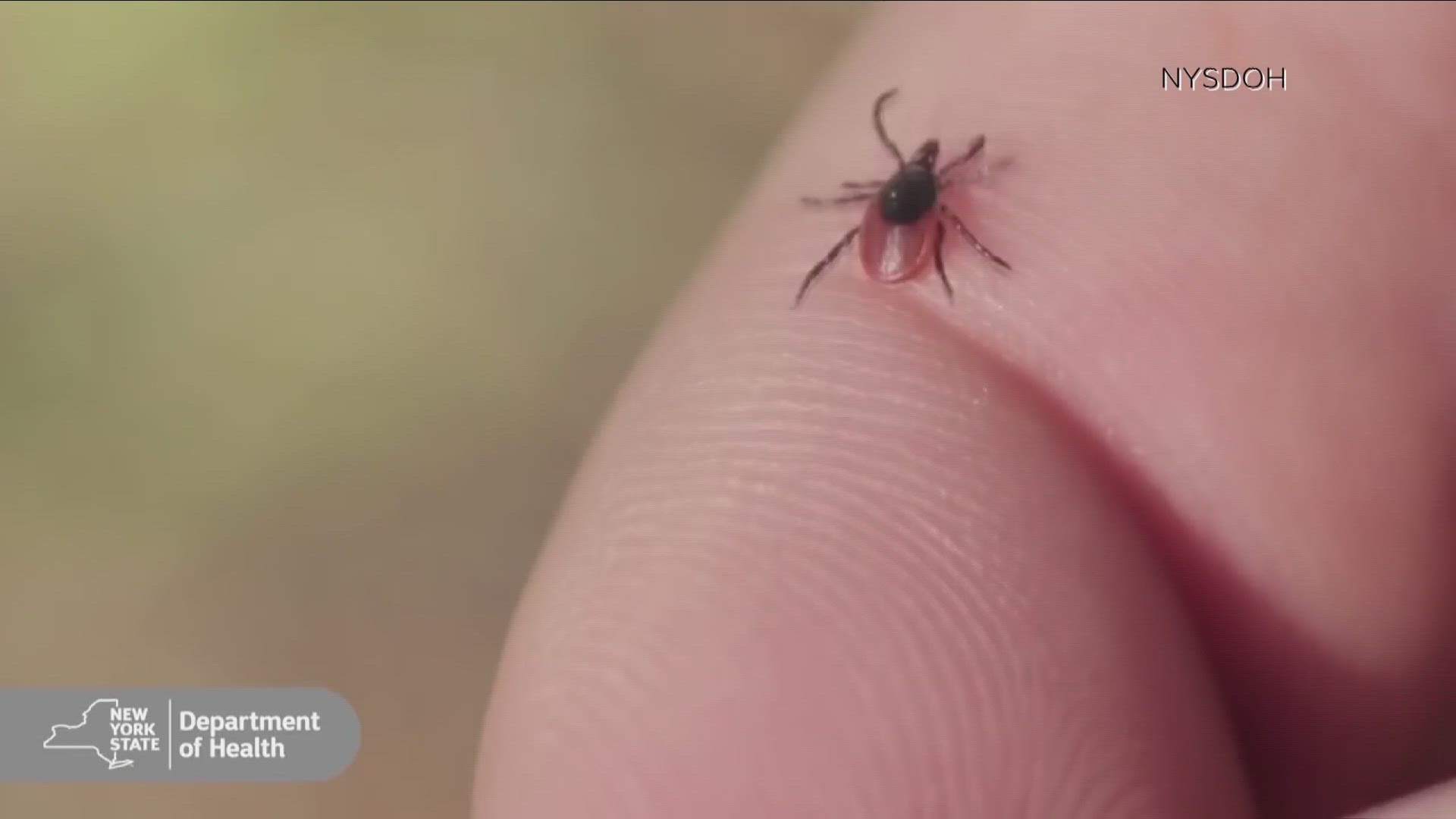 Tick season is approaching in WNY, here's what to know about Lyme disease