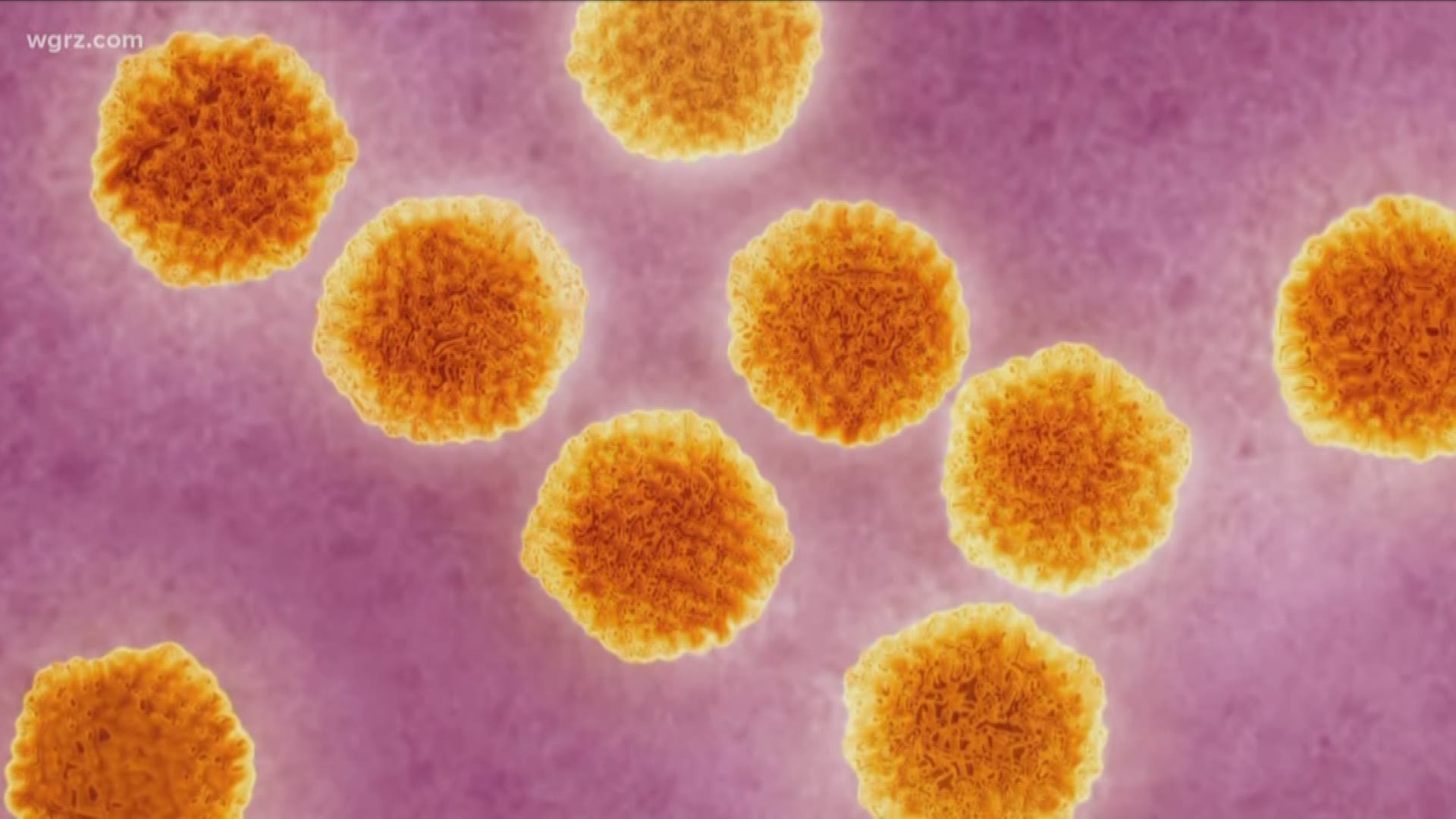 A health scare in the city of Buffalo  with another confirmed case of hepatitis A at a restaurant. This case involves a worker at platinum pizza on Broadway.