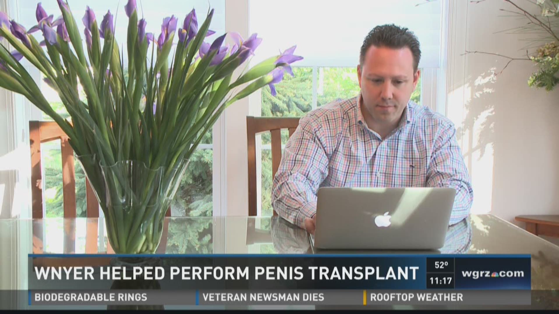 WNY native helped perform penis transplant