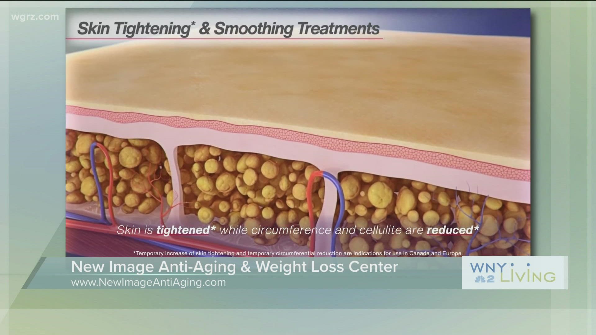 WNY Living - July 9 - New Image Anti-Aging & Weight Loss Center (THIS VIDEO IS SPONSORED BY NEW IMAGE ANTI-AGING & WEIGHT LOSS CENTER)