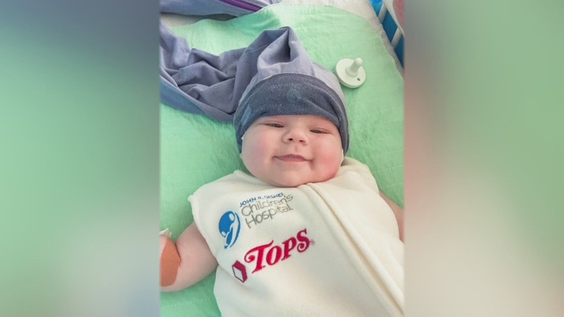 Baby Cam gets approval for critical brain surgery
