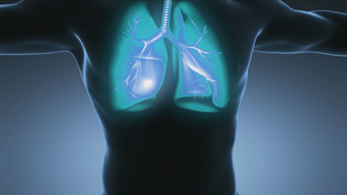 National Lung Cancer screening day is this Saturday | wgrz.com