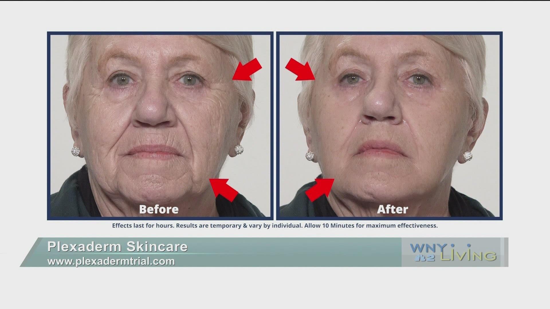 WNY Living - April 17 - Plexaderm Skincare (THIS VIDEO IS SPONSORED BY PLEXADERM SKINCARE)