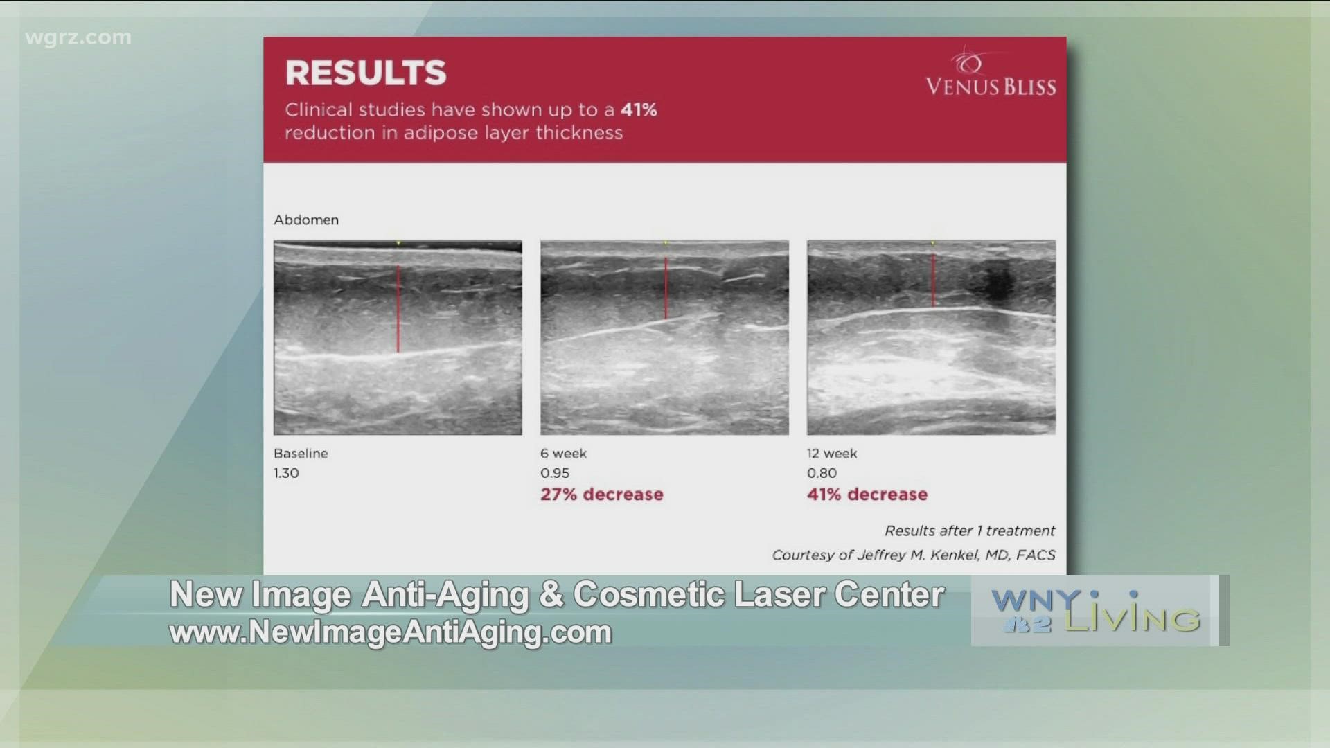 WNY Living - January 22 - New Image Anti-Aging & Cosmetic Laser Center (THIS VIDEO IS SPONSORED BY NEW IMAGE ANTI-AGING & COSMETIC LASER CENTER)