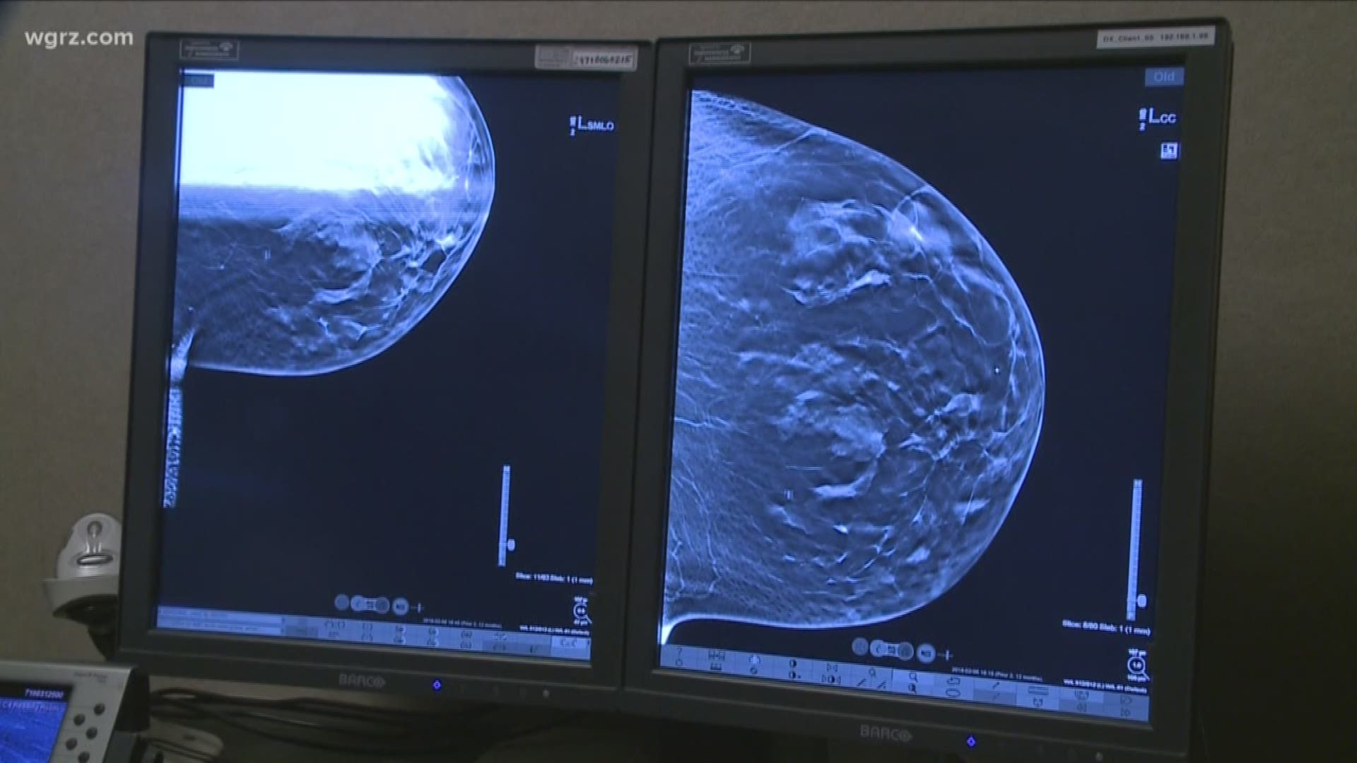 Windsong Uses 3D Breast Cancer Screenings