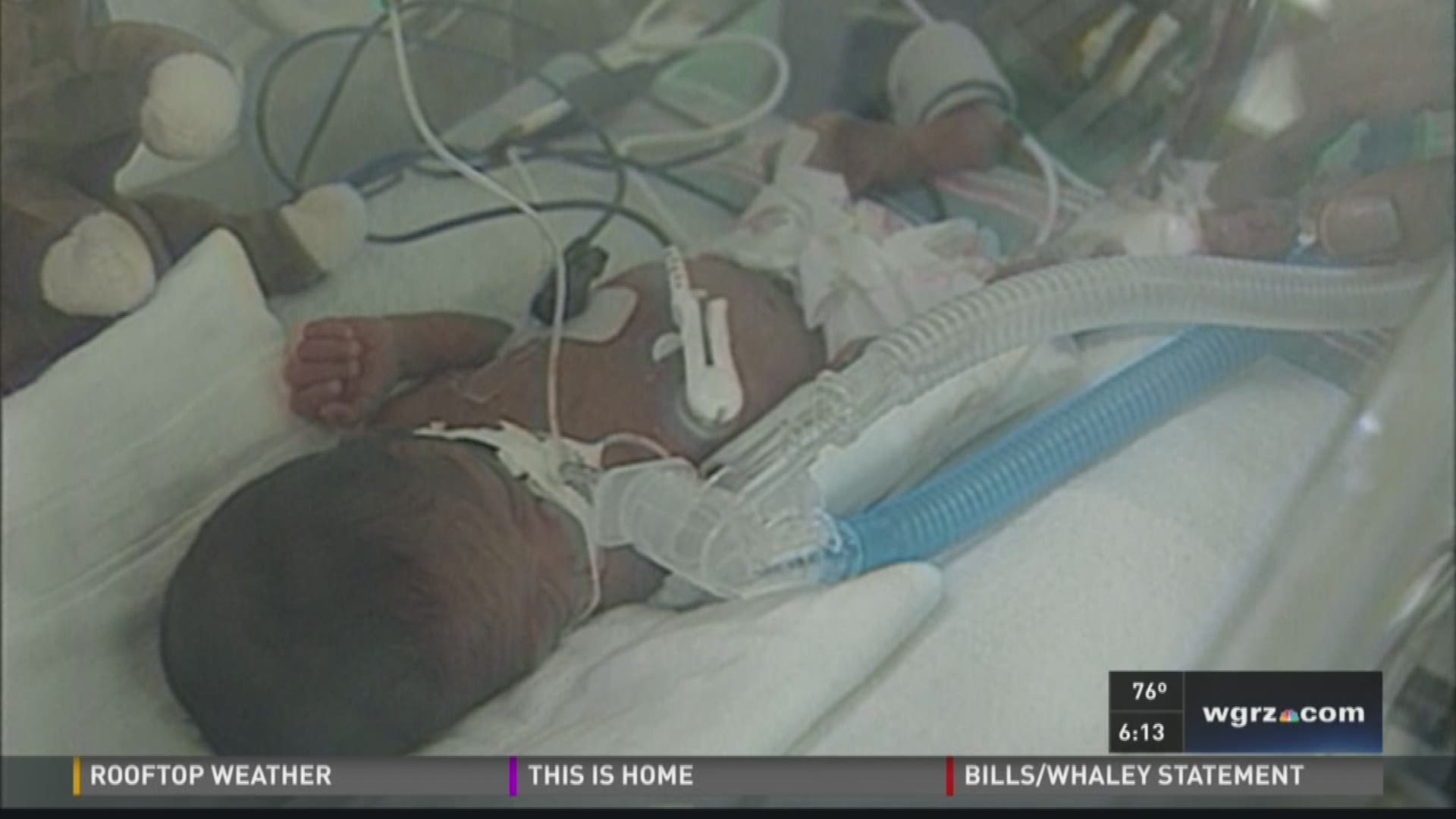 Preemie Beats The Odds "I Came A Long Way"