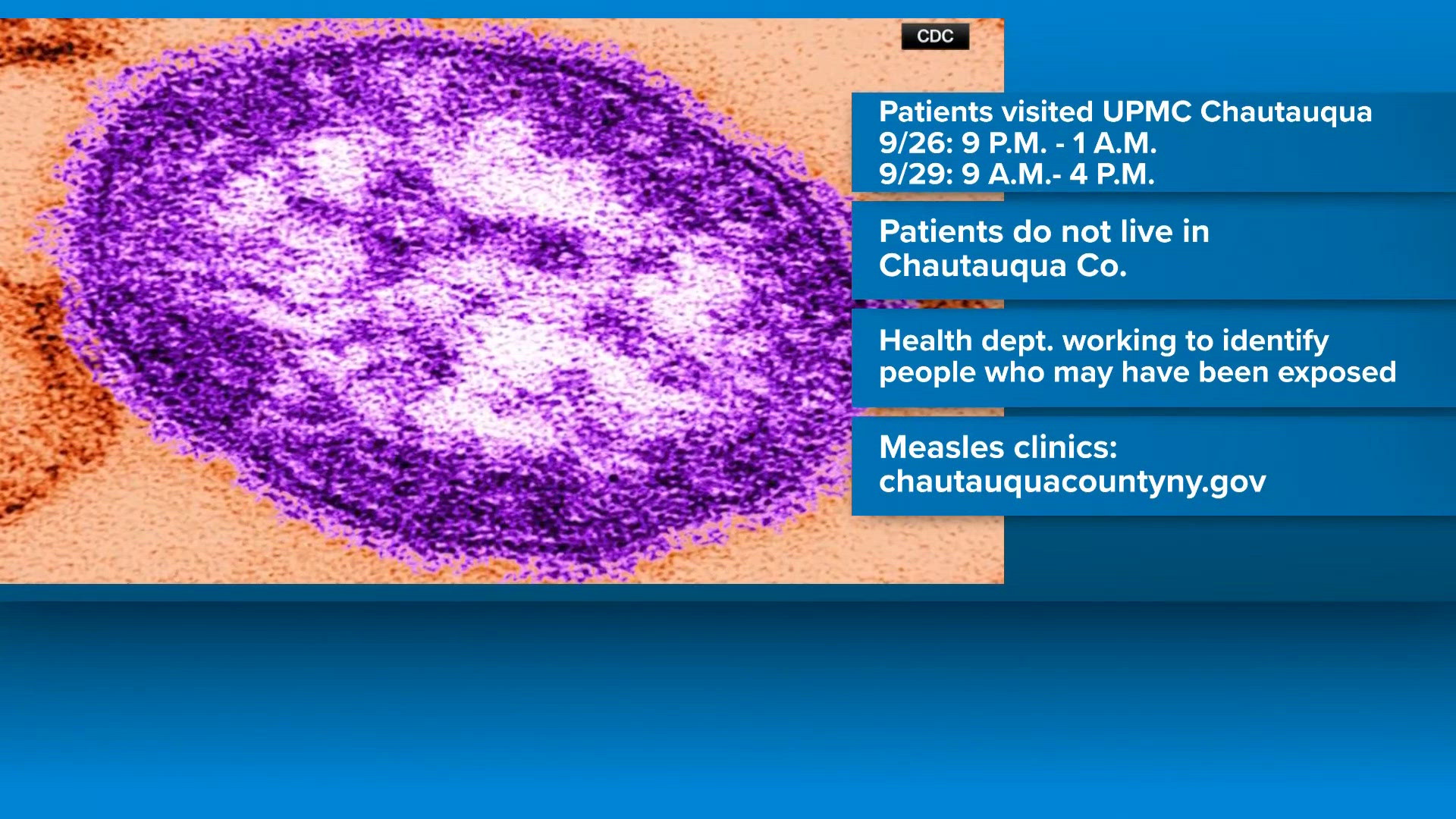 Possible measles exposure reported at Jamestown hospital, health ...