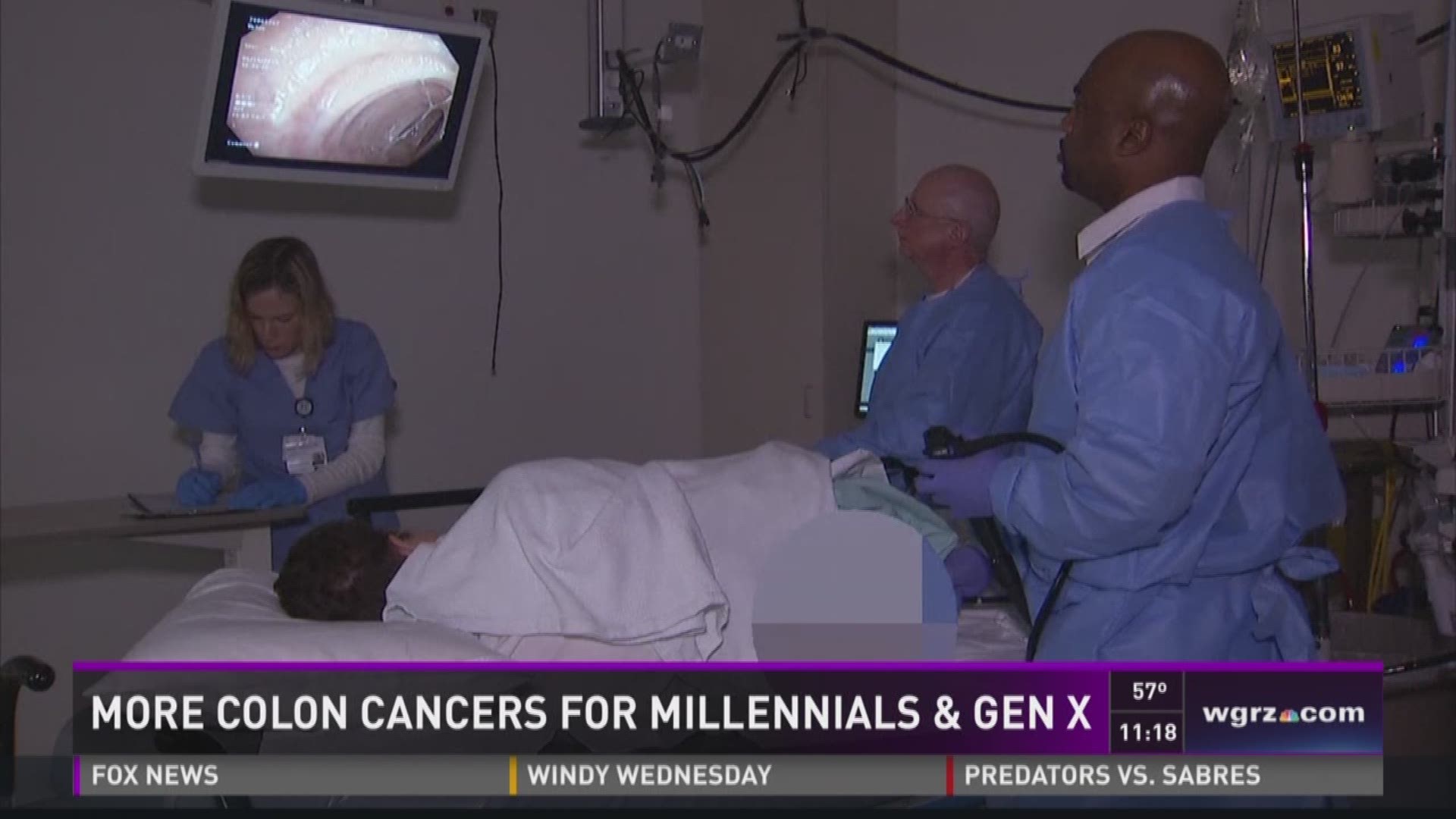 More Colon Cancers For Millennials & Gen X