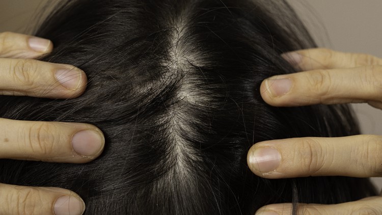Is Skin Cancer of the Scalp the Same as Other Skin Cancers?