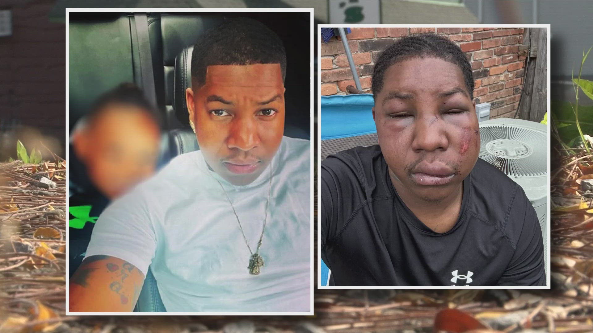 Almost 2 weeks ago a man was inside of a Buffalo bar. He was attacked by a group. His mother is now speaking out because of his injuries, and she wants action.