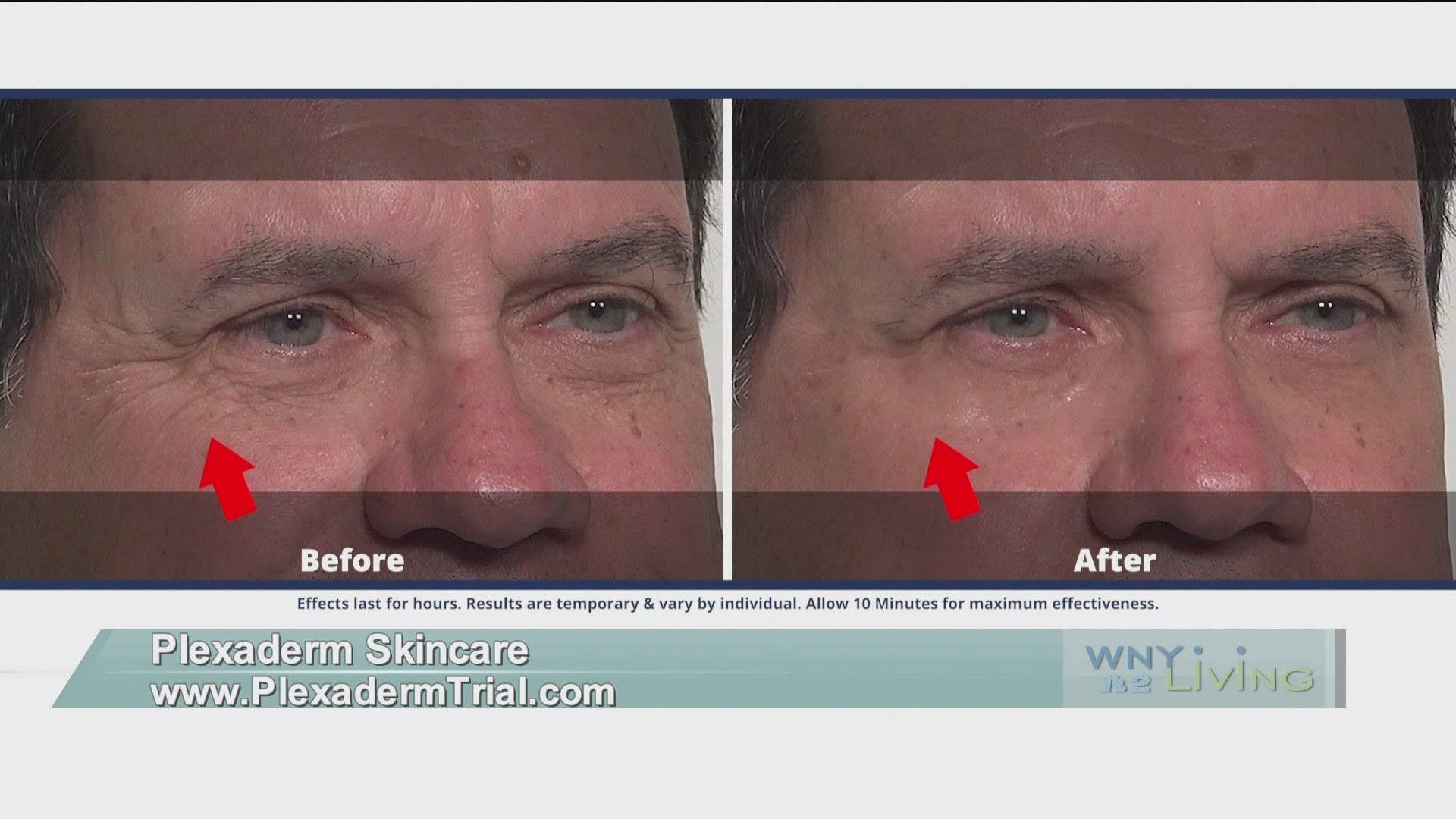 WNY Living - January 9 - Plexaderm Skincare (THIS VIDEO IS SPONSORED BY PLEXADERM SKINCARE)