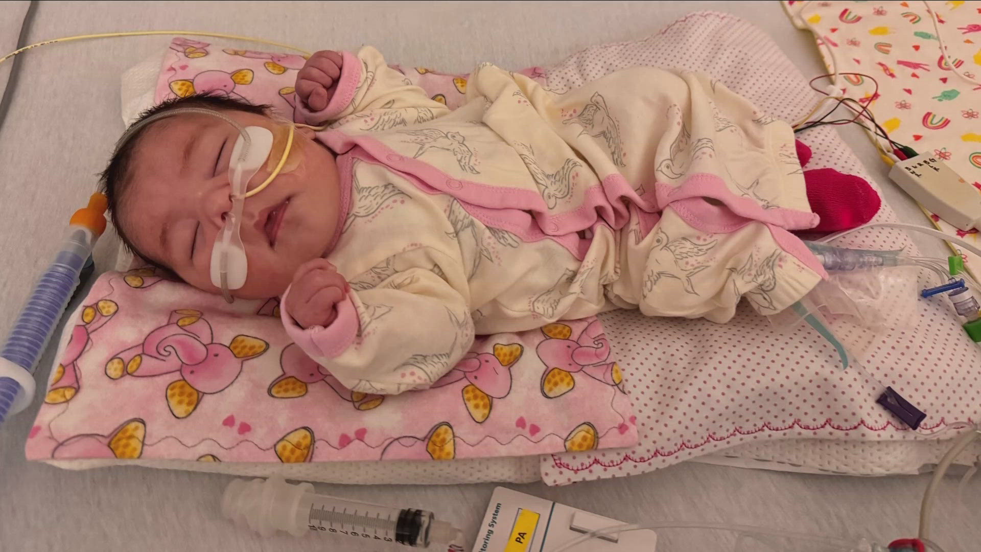 TWO MONTHS OLD BABY SOFIA HAS BEEN DIAGNOSED WITH A SERIOUS HEART DEFECT...