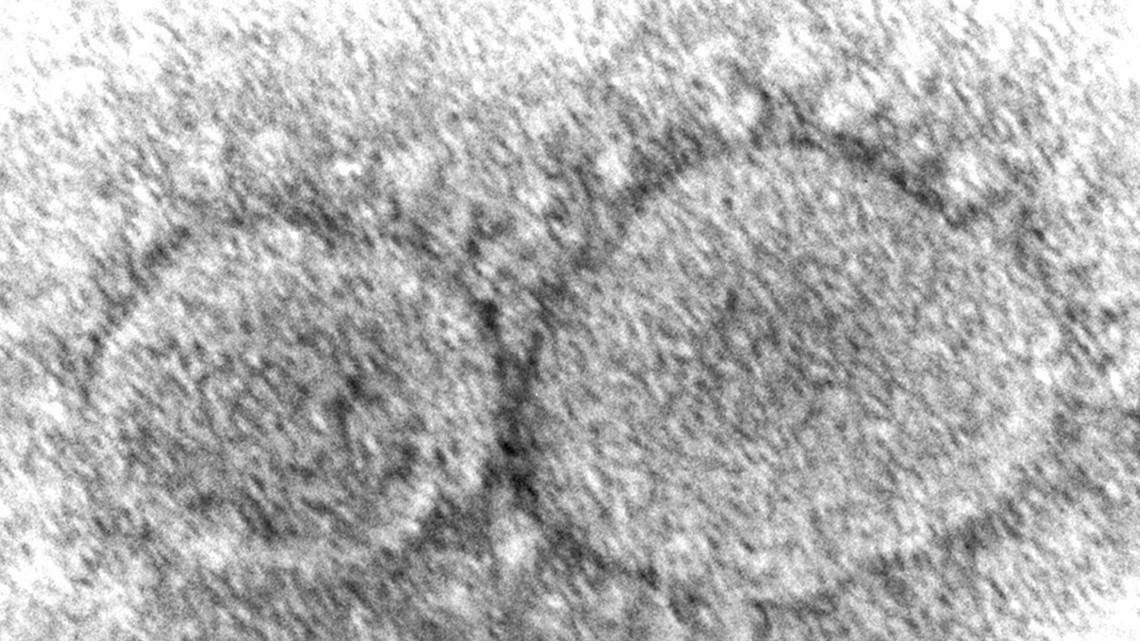 UB researchers discover antiviral gene, known to block HIV, can potentially block SARS-CoV-2 - Vimarsana News