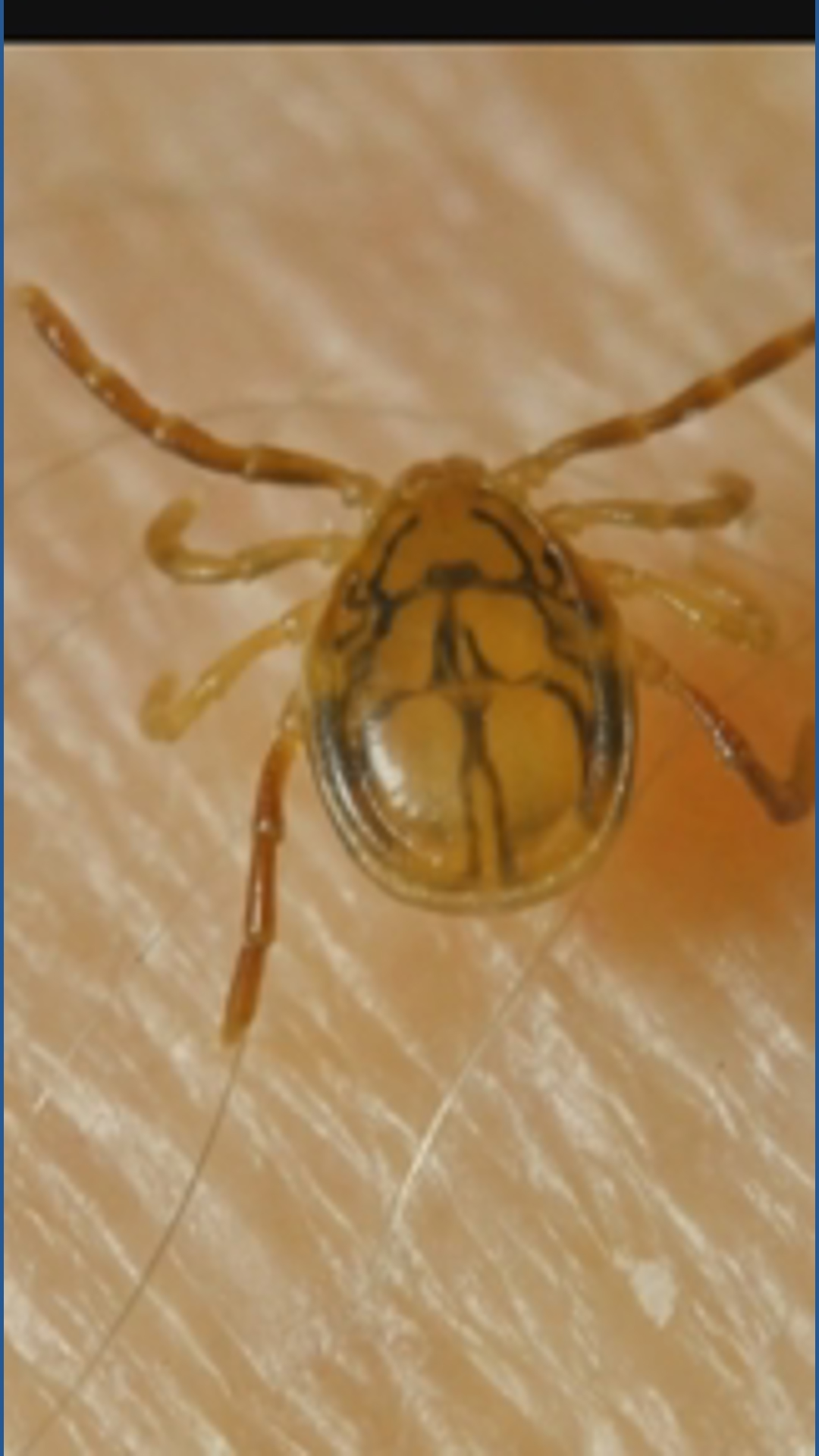 Lyme WNY is raising awareness about Lyme disease