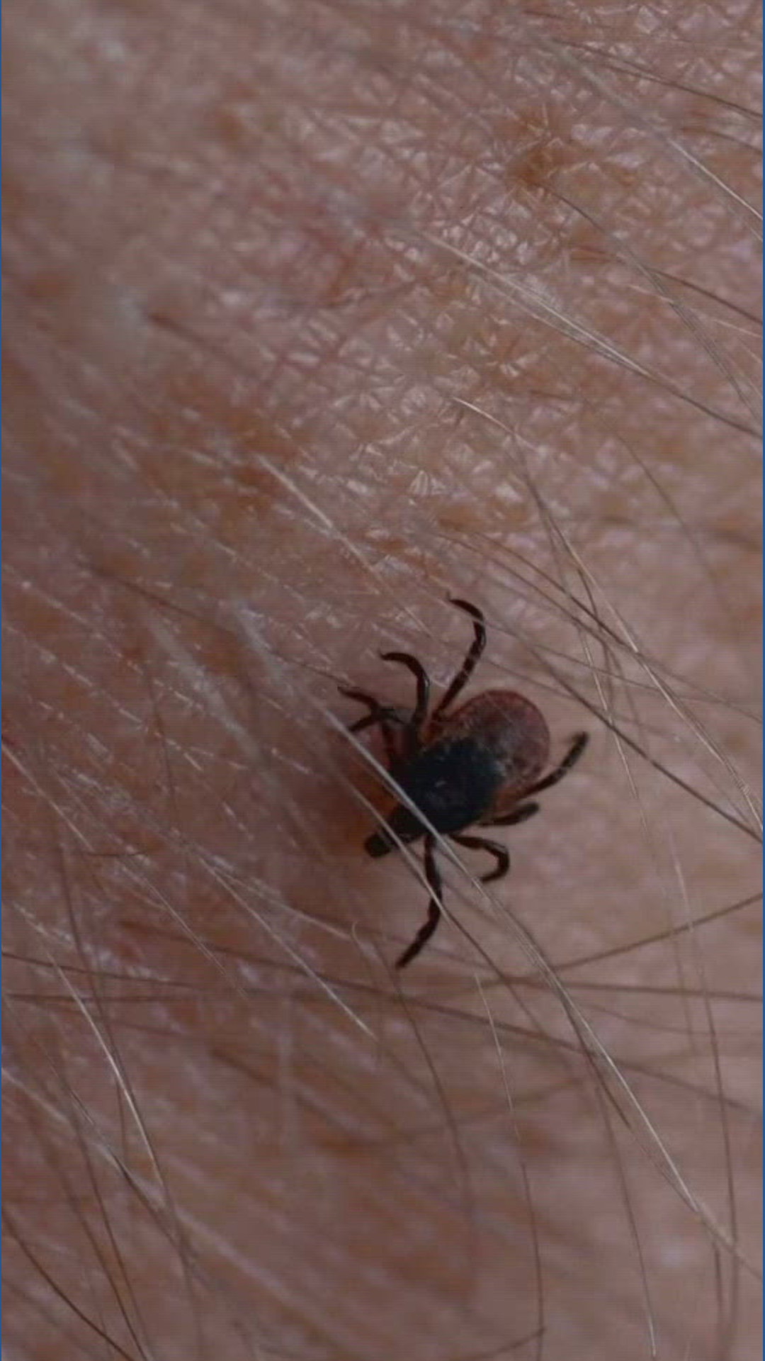 New York State Parks warn of ticks | wgrz.com