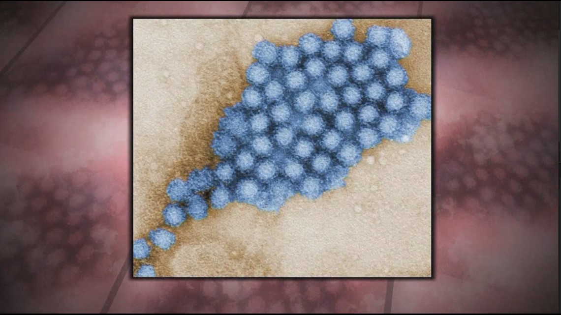 Norovirus on the rise in Western New York