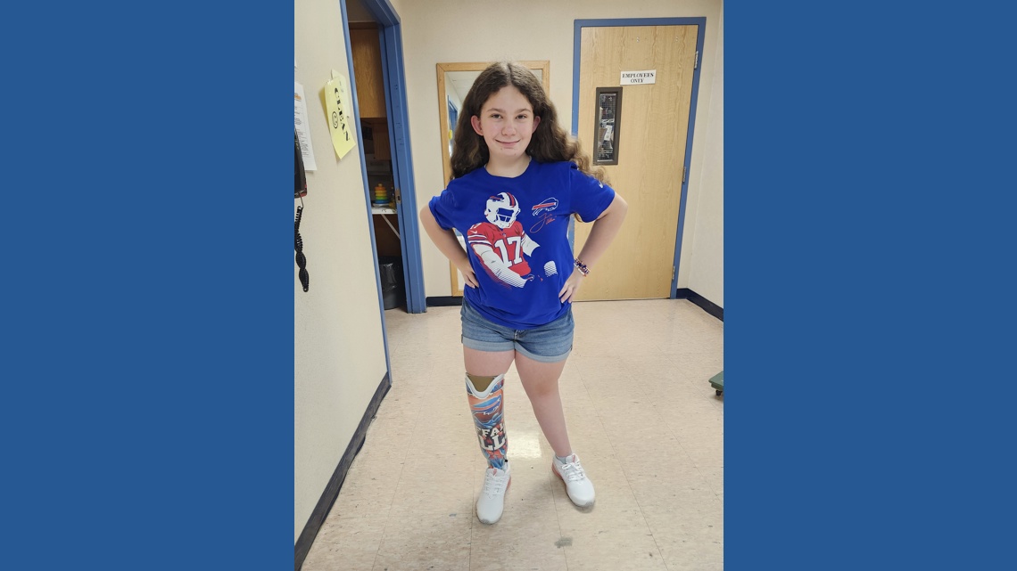 12-year-old girl honors Bills after life-changing surgery