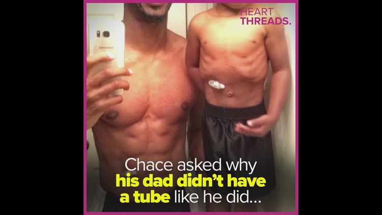 Dad Takes Feeding Tube Selfie With Son Dad Takes Feeding Tube Selfie With Son
